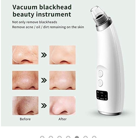 Facial Blackhead Remover Pore Vacuum -Pore Cleaner 5 Suction, Rechargeable - Picture 6 of 15